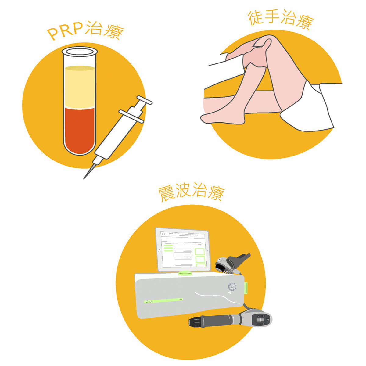髂脛束症候群 髂脛束症候群